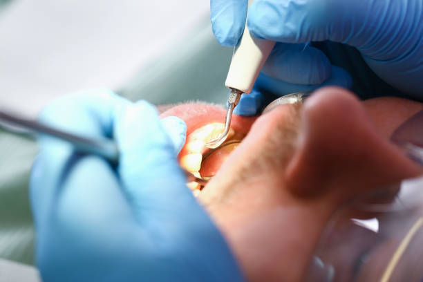 Best Weekend Emergency Dentist in West Columbia, SC